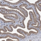 Immunohistochemical staining of human fallopian tube shows moderate membranous and cytoplasmic positivity in glandular cells.