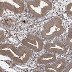 Immunohistochemical staining of human endometrium shows moderate membranous and cytoplasmic positivity in glandular cells.