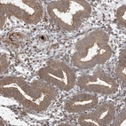 Immunohistochemical staining of human endometrium shows moderate membranous and cytoplasmic positivity in glandular cells.