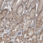 Immunohistochemical staining of human stomach shows strong membranous and cytoplasmic positivity in glandular cells.