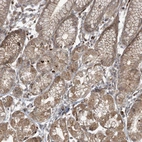 Immunohistochemical staining of human stomach shows strong membranous and cytoplasmic positivity in glandular cells.