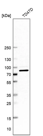 Western blot analysis in human cell line TD47D.