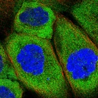 Immunofluorescent staining of human cell line A-431 shows localization to cytosol.