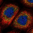 Immunofluorescent staining of human cell line A-431 shows localization to vesicles.
