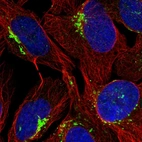 Immunofluorescent staining of human cell line U-2 OS shows localization to the Golgi apparatus & vesicles.