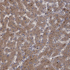 Anti-GCLC Antibody