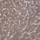 Immunohistochemical staining of human liver shows strong cytoplasmic positivity in hepatocytes.