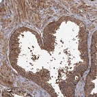 Immunohistochemical staining of human prostate shows strong cytoplasmic positivity in glandular cells.