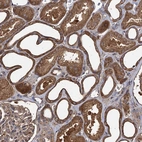 Immunohistochemical staining of human kidney shows strong cytoplasmic positivity in cells in tubules.