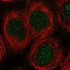 Immunofluorescent staining of human cell line A-431 shows positivity in nucleus.