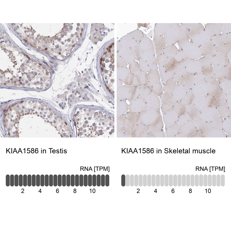 Anti-KIAA1586 Antibody