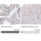 Anti-KIAA1586 Antibody