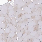 Immunohistochemical staining of human skeletal muscle shows low expression as expected.