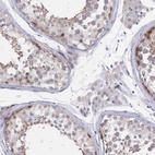 Immunohistochemical staining of human testis shows high expression.