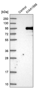 Western blot analysis in control (vector only transfected HEK293T lysate) and KIAA1586 over-expression lysate (Co-expressed with a C-terminal myc-DDK tag (~3.1 kDa) in mammalian HEK293T cells, LY412227).