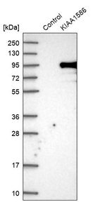 Anti-KIAA1586 Antibody