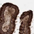 Immunohistochemical staining of human colon using Anti-LRPPRC antibody HPA036409.