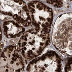 Immunohistochemical staining of human kidney using Anti-LRPPRC antibody HPA036409.