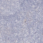 Immunohistochemical staining of human lymph node shows low expression as expected.