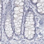Immunohistochemical staining of human colon using Anti-DMGDH antibody HPA036441.