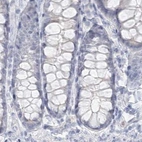 Immunohistochemical staining of human colon using Anti-DMGDH antibody HPA036441.