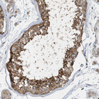 Anti-SPATA5 Antibody