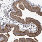 Immunohistochemical staining of human fallopian tube shows strong cytoplasmic positivity in glandular cells.