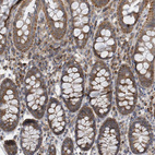 Immunohistochemical staining of human colon shows strong cytoplasmic positivity in glandular cells.