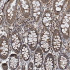 Immunohistochemical staining of human colon shows strong cytoplasmic positivity in glandular cells.