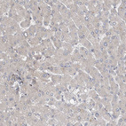 Immunohistochemical staining of human liver shows no positivity in hepatocytes as expected.