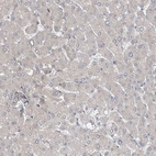 Immunohistochemical staining of human liver shows no positivity in hepatocytes as expected.