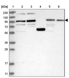 Lane 1: Marker [kDa] 230, 130, 95, 72, 56, 36, 28, 17, 11_br/_Lane 2: Human cell line RT-4_br/_Lane 3: Human cell line U-251 MG_br/_Lane 4: Human plasma_br/_Lane 5: Human Liver tissue_br/_Lane 6: Human Tonsil tissue
