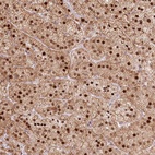 Anti-PYURF Antibody