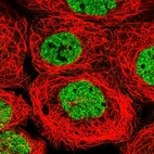 Immunofluorescent staining of human cell line A-431 shows localization to nucleoplasm.