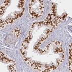 Anti-SPINK13 Antibody