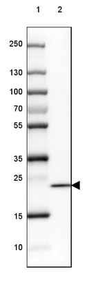 Lane 1: Marker [kDa] 250, 130, 100, 70, 55, 35, 25, 15, 10_br/_Lane 2: Human cell line HeLa