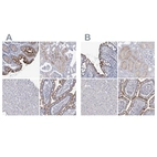 Immunohistochemical staining of human colon, kidney, liver and small intestine using Anti-SLC9A3 antibody HPA036493 (A) shows similar protein distribution across tissues to independent antibody HPA036669 (B).