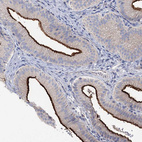 Immunohistochemical staining of human gallbladder shows strong positivity in apical membrane in glandular cells.