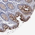 Immunohistochemical staining of human colon shows strong positivity in apical membrane in glandular cells.