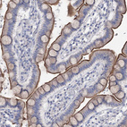 Immunohistochemical staining of human small intestine shows moderate positivity in apical membrane in glandular cells.
