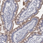Immunohistochemical staining of human small intestine shows moderate positivity in apical membrane in glandular cells.