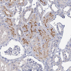 Immunohistochemical staining of human kidney shows moderate positivity in apical membrane in cells in tubules.