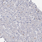 Immunohistochemical staining of human liver shows no membranous positivity in hepatocytes as expected.