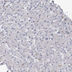 Immunohistochemical staining of human liver shows no membranous positivity in hepatocytes as expected.