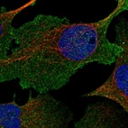 Immunofluorescent staining of human cell line U-2 OS shows localization to plasma membrane.