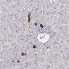 Immunohistochemical staining of human liver shows strong membranous positivity in cholangiocytes.