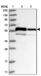 Lane 1: Marker [kDa] 230, 130, 95, 72, 56, 36, 28, 17, 11_br/_Lane 2: Human cell line RT-4_br/_Lane 3: Human cell line U-251MG sp