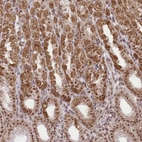Anti-ZMAT2 Antibody