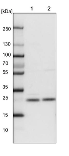 Lane 1: NIH-3T3 cell lysate (Mouse embryonic fibroblast cells)_br/_Lane 2: NBT-II cell lysate (Rat Wistar bladder tumour cells)