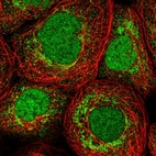 Immunofluorescent staining of human cell line A-431 shows localization to nucleus & mitochondria.